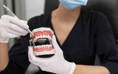 Types of Dental Crowns and Cost